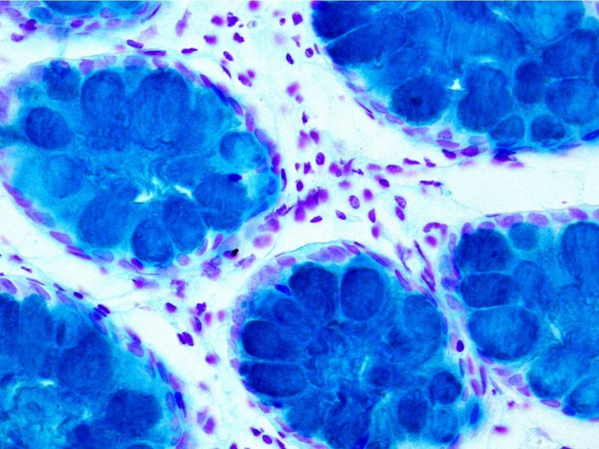 Methylene Blue as a Stain | What is it used for with Example – Macsen Labs Methylene Blue as a Stain | What is it used for with Example – Macsen Labs